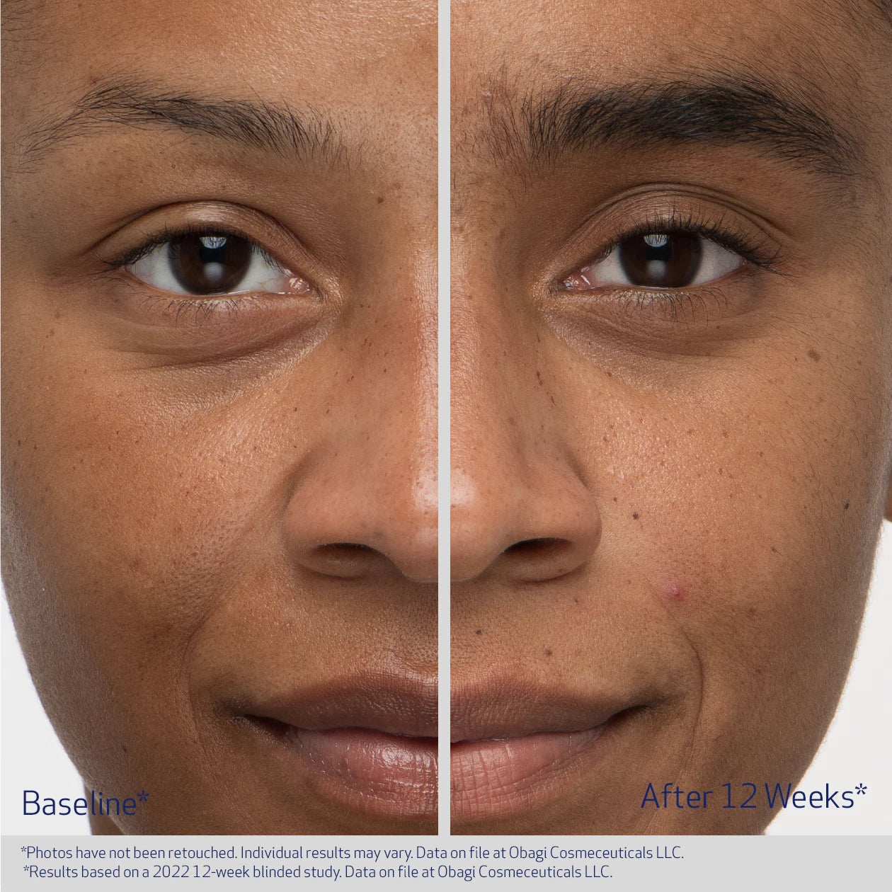 Obagi Medical Nu-Cil Eyebrow Boosting Serum