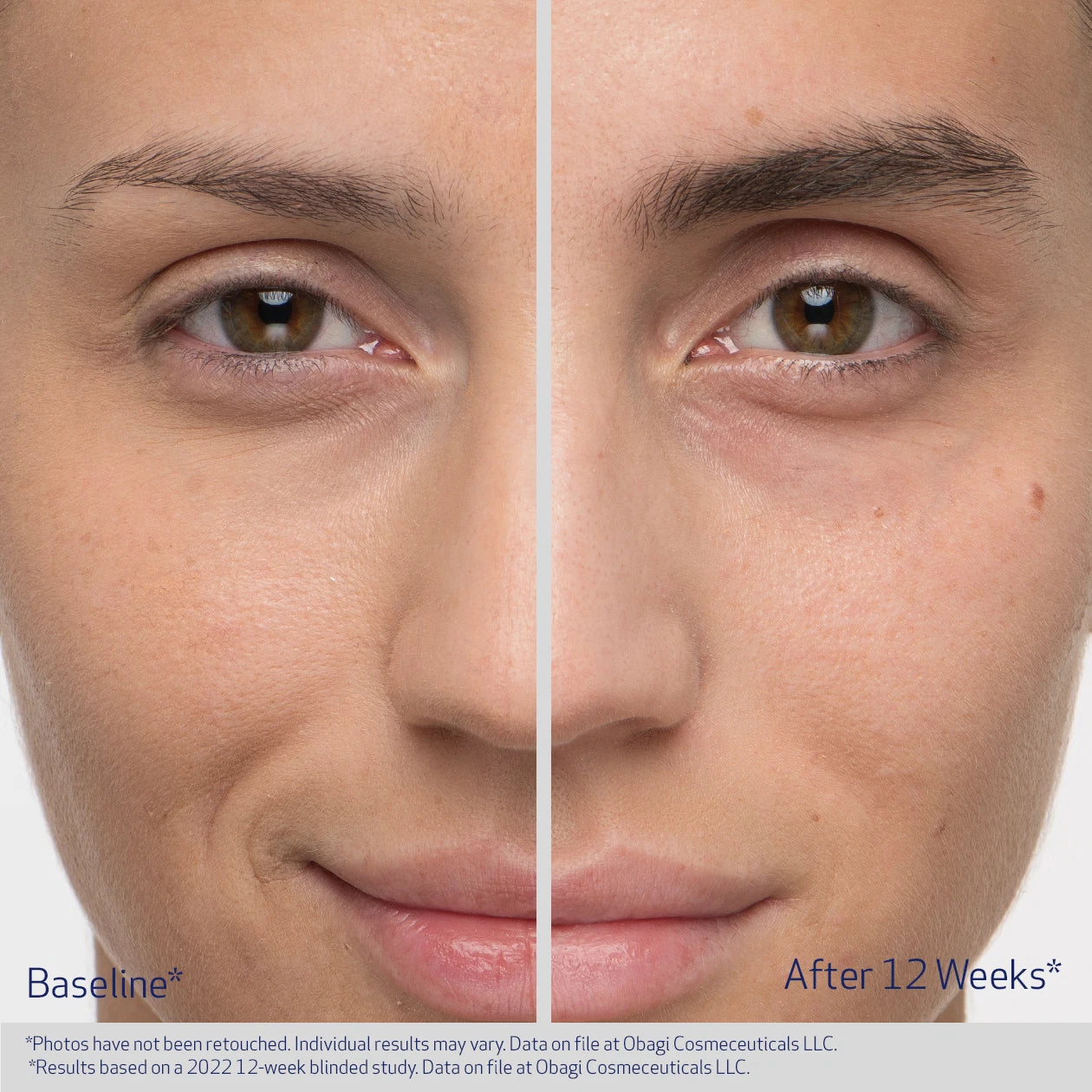Obagi Medical Nu-Cil Eyebrow Boosting Serum