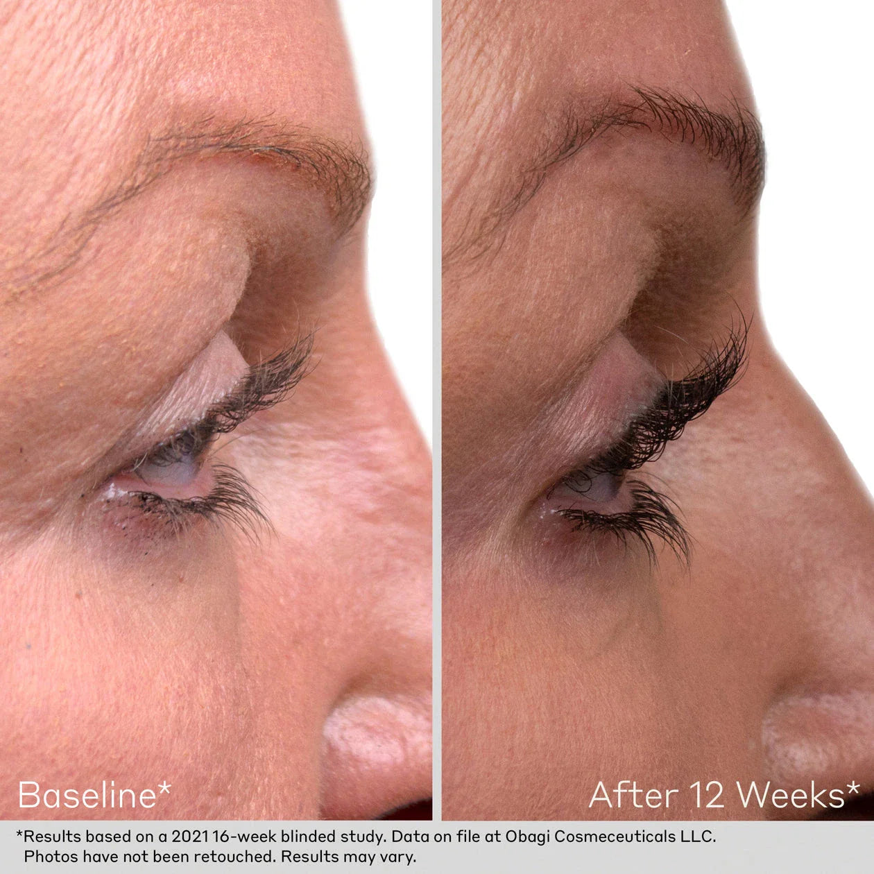 Obagi Lash & Brow Serum Set